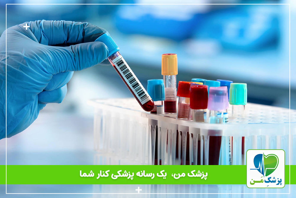 تفسیر آزمایش کراتینین سرم و مقدار طبیعی آن