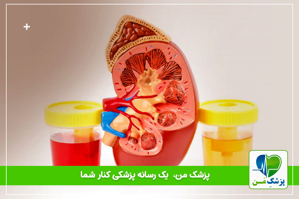 صفر تا صد آزمایش کلیه و جواب آن