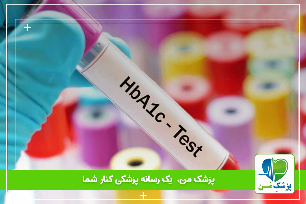 بیماری هایی که باعث خطا در a1c میشن!