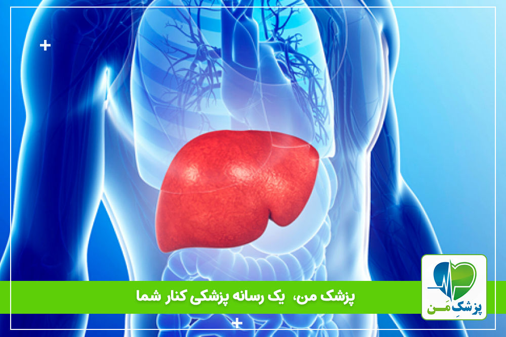 کبد چرب چیست؟علل، علایم و درمان آن