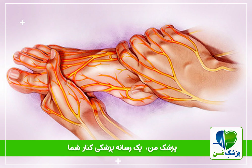 نوروپاتی دیابتی چیست؟( علل، علائم و راه های درمان آن)