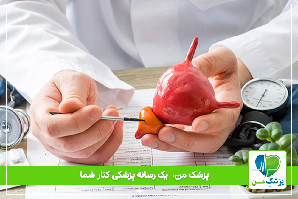 پروستات چیست؟ (انواع پروستات، علائم و درمان آن)