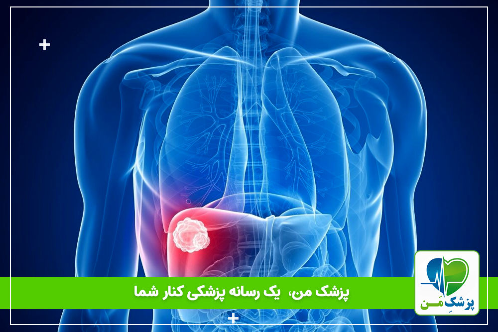 هپاتیت چیست؟ (راه های تشخیص و درمان آن)