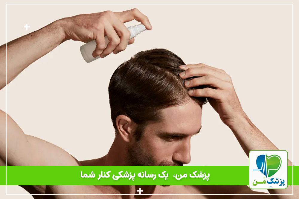 ماینوکسیدیل  (مزایا ٬ عوارض و نحوه‌ی مصرف آن)