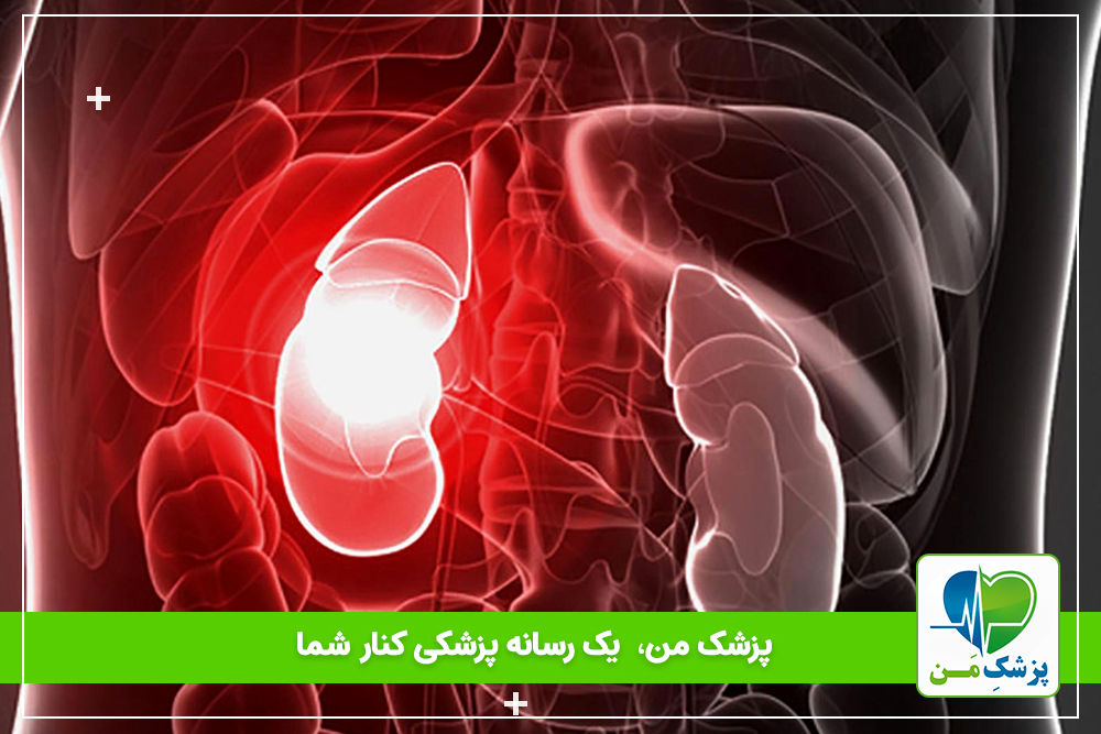 بیماری های کلیوی (علائم و درمان)