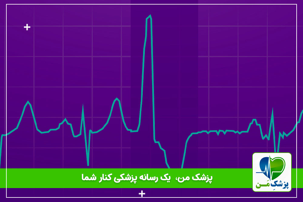 انقباض زودرس بطنی یا PVC!