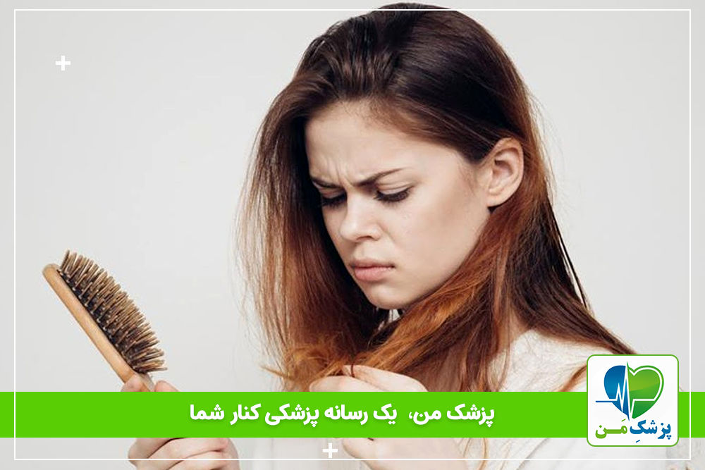 مهمترین علل ریزش مو در زنان و گزینه های درمانی موجود