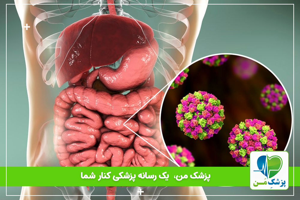 ۹ بیماری رایج گوارشی از بالا تا پایین