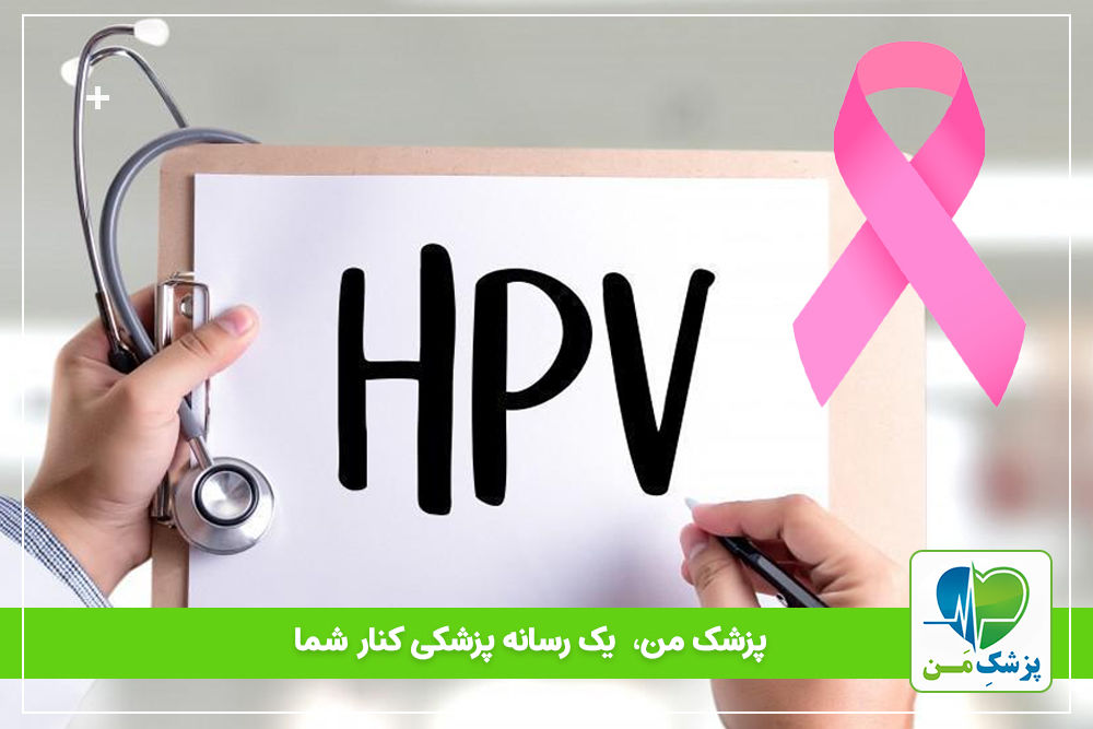 ارتباط بین HPV و سرطان پستان