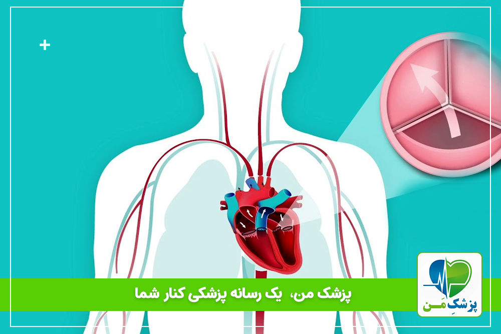 بیماری ها و اختلالات دریچه ای قلب همراه با عوامل و درمان