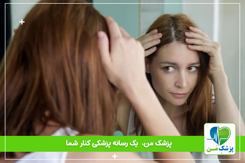 علت ریزش مو بعد از رژیم لاغری – پیشگیری و درمان