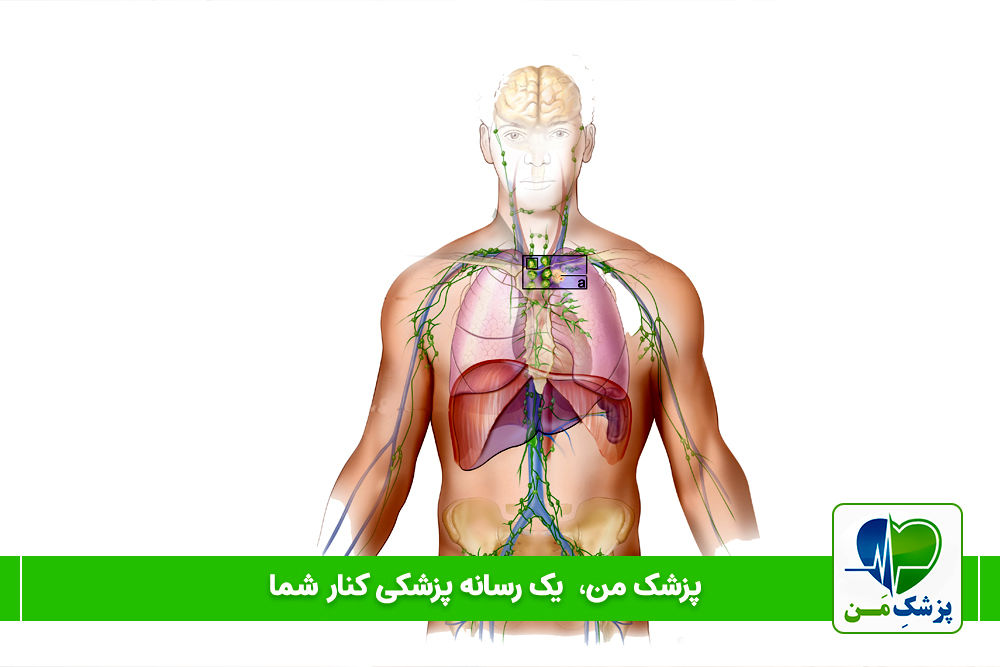 غدد لنفادنوپاتی محیطی
