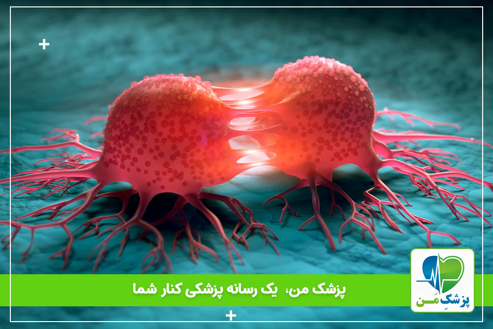 معرفی تومور های اعصاب و غدد