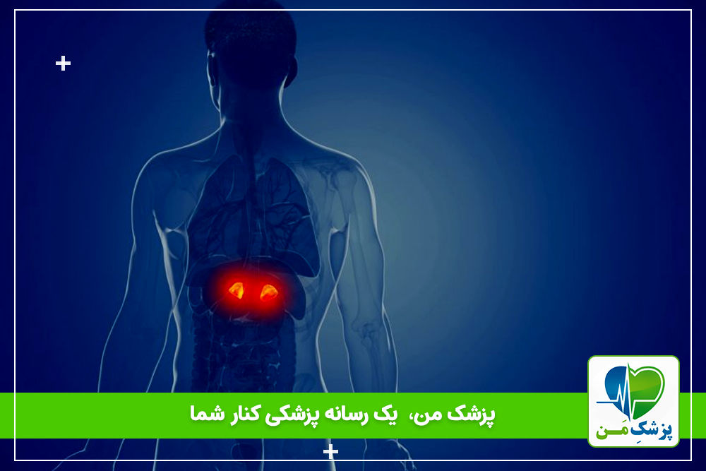 سندرم کوشینگ چیست وچه کسانی آن را دریافت میکنند؟