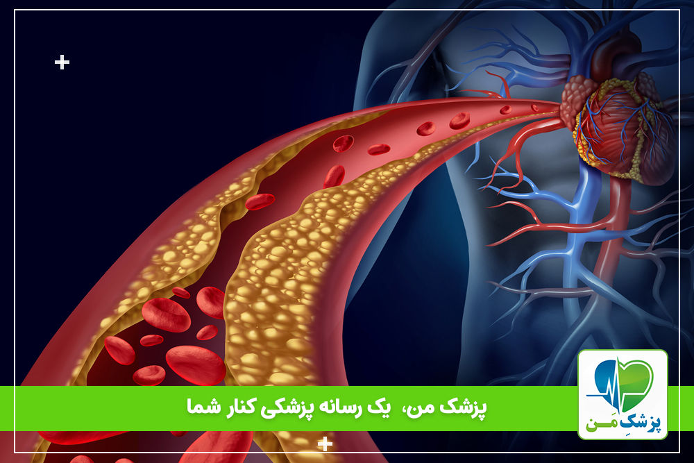 چگونه می‌توان از حمله قلبی، جان سالم به در برد؟