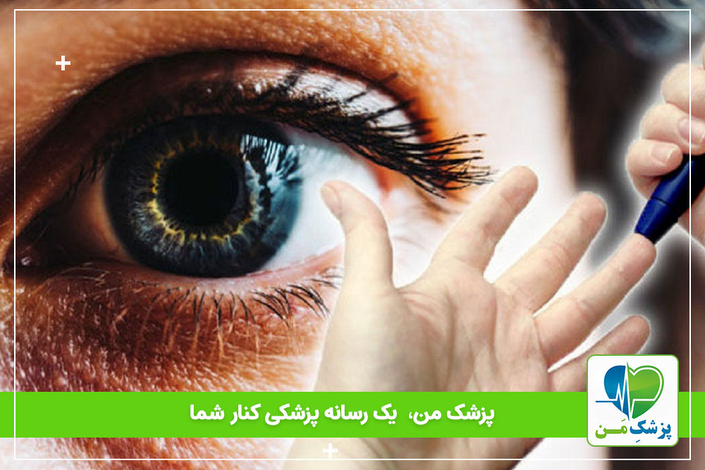 راه پیشگیری از عوارض چشمی دیابتی ها