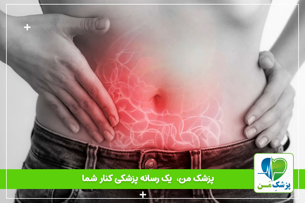 10 دلیل برای اینکه همیشه شکم دارید وجود دارد