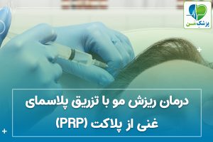 درمان ریزش مو با تزریق پلاسمای غنی از پلاکت (PRP)