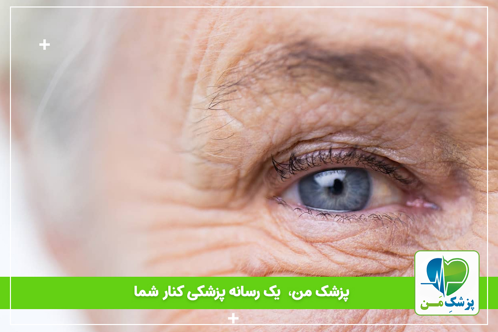 مشکلات چشمی در افزایش سن
