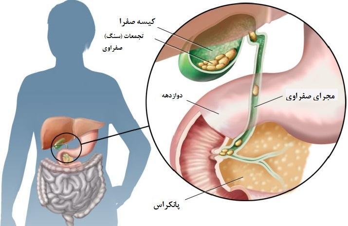 کیسه صفرا در کجا قرار دارد؟ کار آن چیست؟