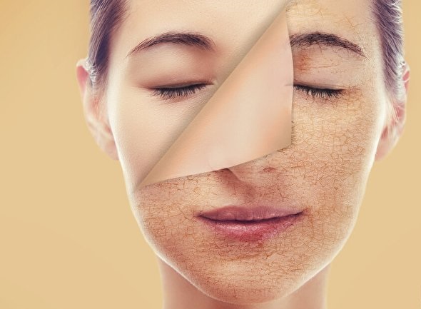 چگونه رطوبت پوست را در گرمای تابستان حفظ کنیم؟